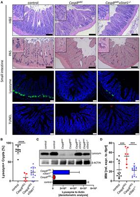 An IFN-STAT Axis Augments Tissue Damage and Inflammation in a Mouse Model of Crohn's Disease